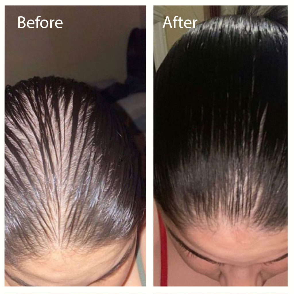 🌿 ZOJJA™ Natural Hair Growth Oil